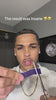 close up of purple whitening strips on teeth removing stains and yellow discoloration