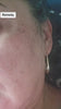 woman applying KOEC advanced dark spot serum for brighter even skin tone